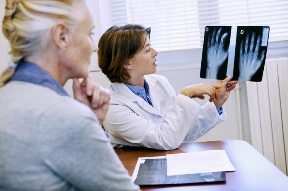 El paracetamol no sería eficaz para tratar la artrosis