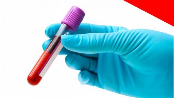 Estudio concluye que no es necesario ayunar previo un análisis de sangre para medir el colesterol