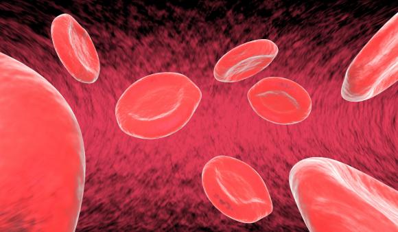 Talasemia: una severa anemia que hoy tiene tratamiento