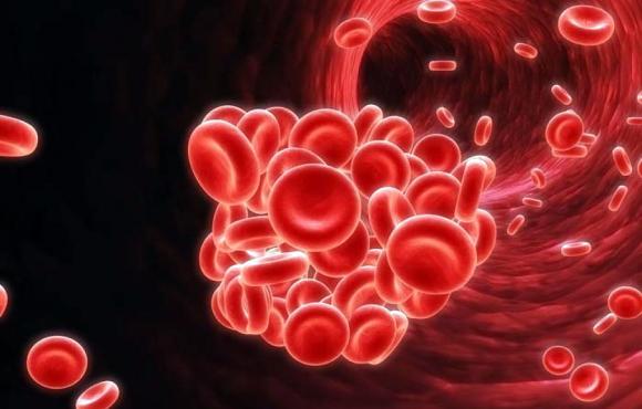 ITP: Una enfermedad de la sangre que afecta a niños y a adultos mayores