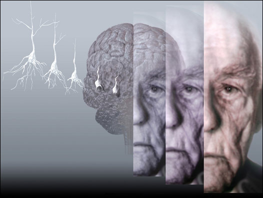 SAN ISIDRO: Talleres que enseñan a cuidar a personas con Alzheimer
