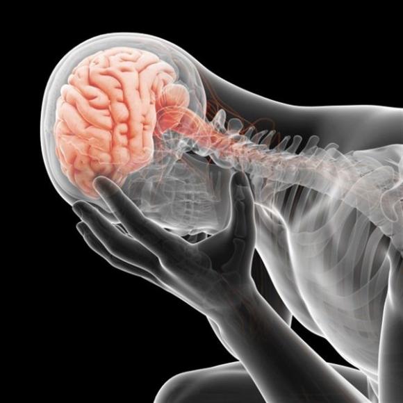 Se calcula que en Argentina hay un ACV cada 9 minutos