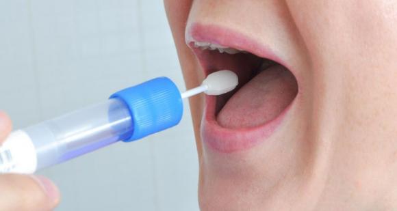 Con una muestra de saliva se puede prevenir la trasmisión de enfermedades genéticas