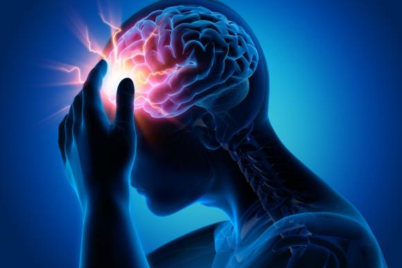 Cómo evitar que las migrañas comprometan la calidad de vida