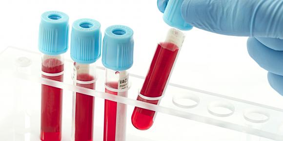 Se podrá hacer sin orden médica el test de HIV en hospitales públicos