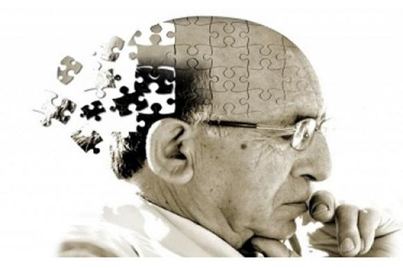 Científicos argentinos descubrieron la causa del Alzheimer