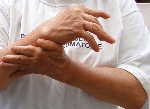 SAN ISIDRO: Actividades gratuitas para ayudar a pacientes reumáticos