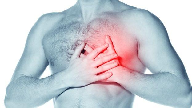 Confirmado: la dieta y el estilo de vida son responsables de los infartos
