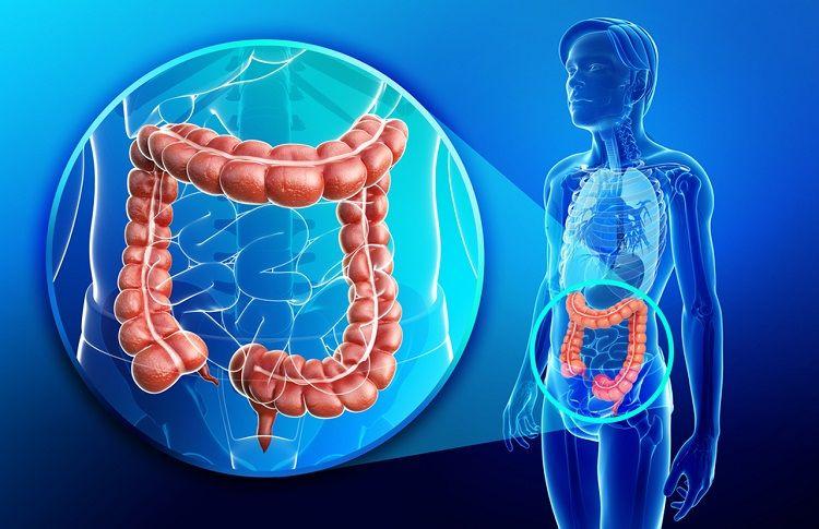 Cáncer Colorrectal: El más prevenible