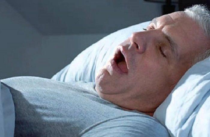 La apnea del sueño aumenta la probabilidad de trastorno del ritmo cardíaco