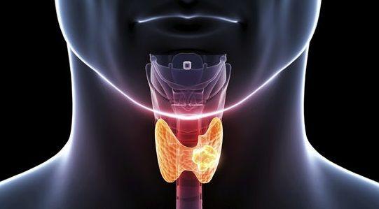 Hipotiroidismo, un problema de salud muchas veces con diagnóstico erróneo