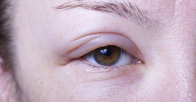 En 10 años los pacientes con angioedema hereditario tendrían una vida completamente normal