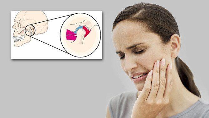 Trastornos de la articulación temporomandibular (ATM)