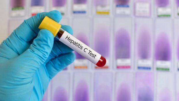 Incorporarán el test rápido de Hepatitis C al Programa Nacional