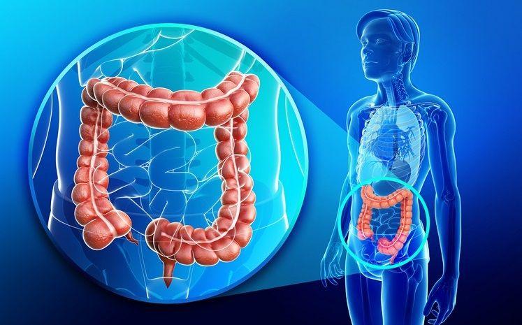 Probióticos: Pueden ser muy útiles para prevenir y tratar el cáncer de colon