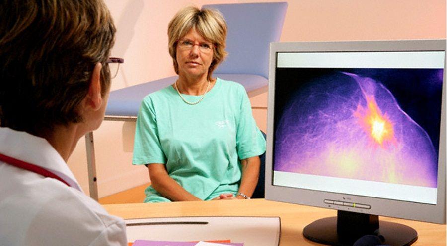 La mitad de los tumores neuroendócrinos se diagnostican tarde