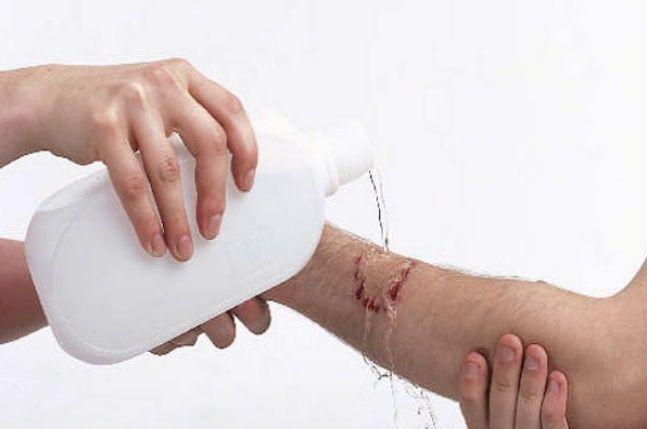 Las lesiones cutáneas se curan más rápido si se producen durante el día