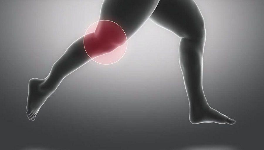 La obesidad aumenta las dislocaciones de la rodilla