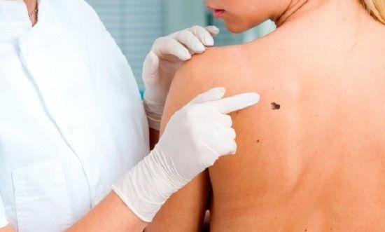 San Isidro: Más de 300 personas participaron en la Campaña Nacional de Prevención del Cáncer de Piel