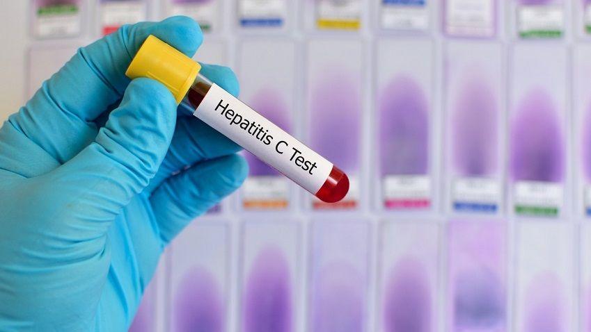 Encuesta: 7 de cada 10 argentinos nunca se realizaron el test de la hepatitis C