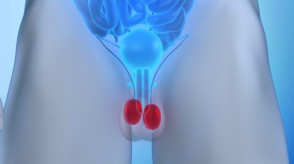 ¿Puede el varicocele aumentar los riesgos cardíacos?