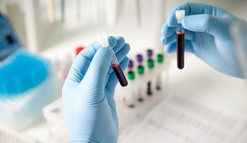Crean test de sangre capaz de detectar de forma temprana 8 tipos de cáncer