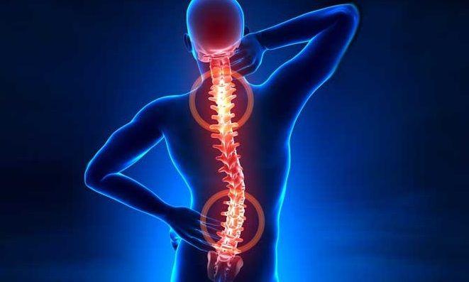 Hernia de disco: Qué es, síntomas, causas, prevención y tratamiento