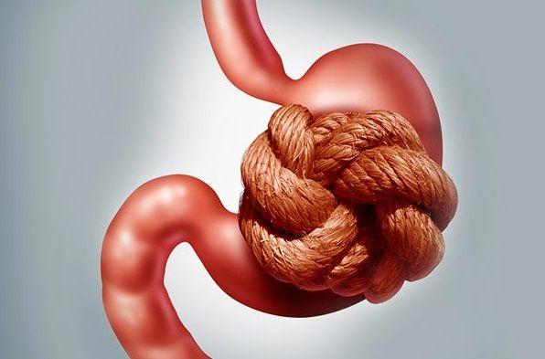 Estreñimiento: Qué es, síntomas, causas, diagnóstico, prevención y tratamiento