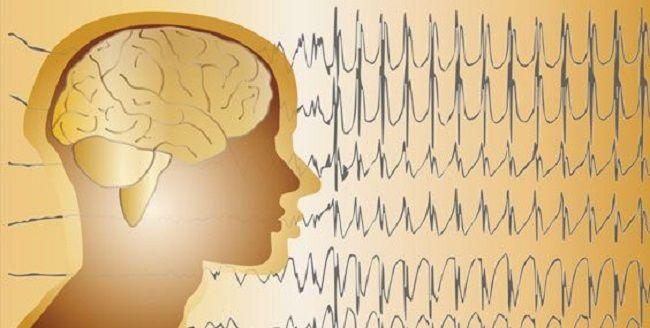 Presentaron nueva guía sobre la dieta cetogénica para el manejo integral de la epilepsia
