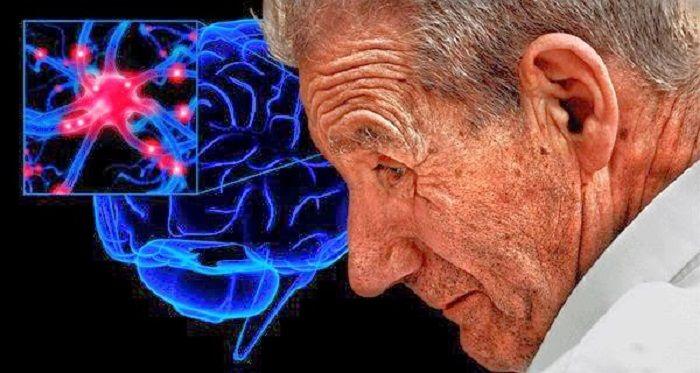 Crean un marcapasos cerebral que ayuda a personas con Alzheimer