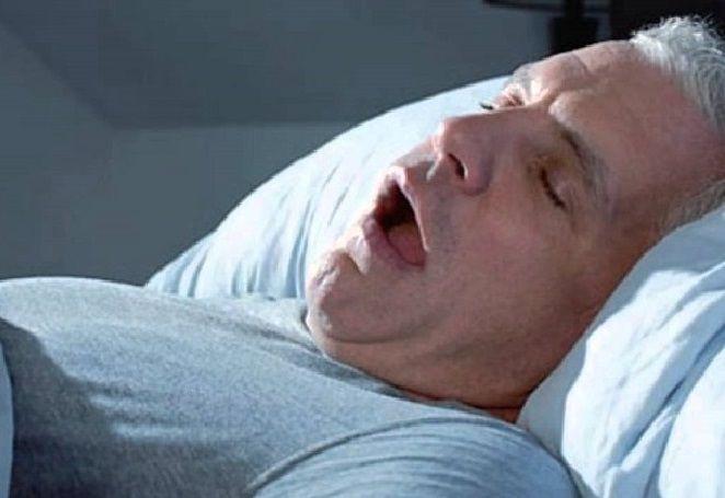 Apnea del sueño: Qué es, que ocasiona, diagnóstico prevención y tratamiento