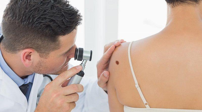 LALCEC brinda controles gratuitos de piel para prevenir el cáncer