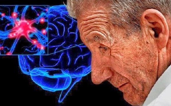 El exceso de calcio podría influir en el desarrollo de la enfermedad de Parkinson