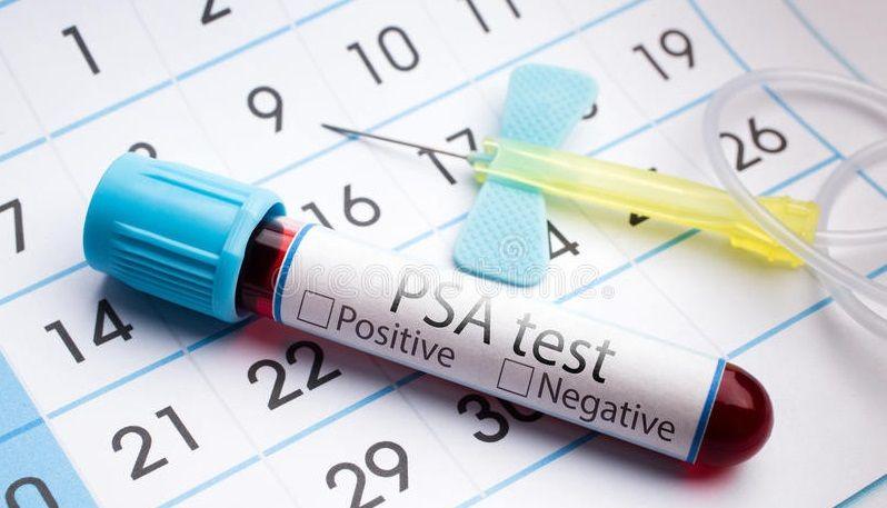 Qué es el análisis del antígeno prostático específico (PSA)