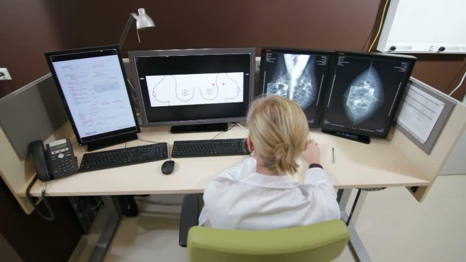 Un estudio permitiría saber si el cáncer de mama responderá a la quimioterapia