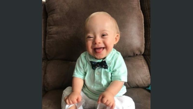 La «sonrisa y la expresión alegre» de un niño con síndrome de Down, nueva imagen de Gerber