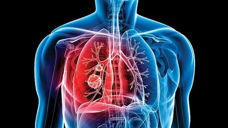 En Argentina se notifican más de 10 mil casos anuales de tuberculosis