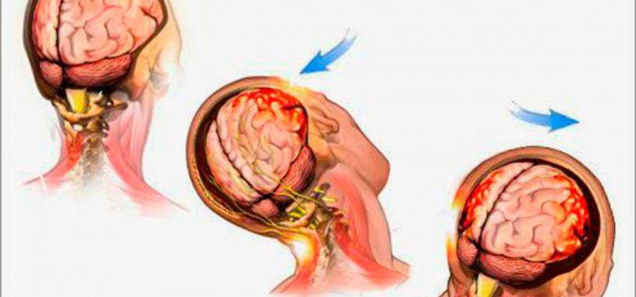Cada año fallecen más de un millón de personas por accidentes de tránsito