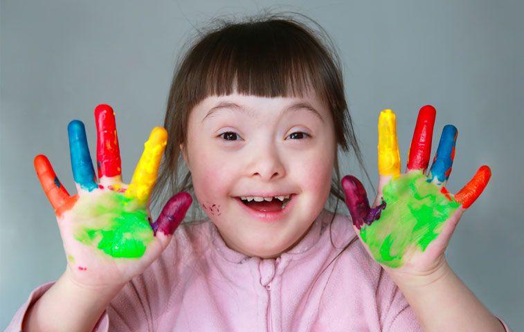 Síndrome de Down: Qué es, síntomas, causas, diagnóstico y tratamiento