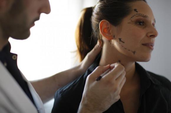 HILOS PDS, UNA NUEVA OPCIÓN MÍNIMAMENTE INVASIVA PARA EL REJUVENECIMIENTO FACIAL