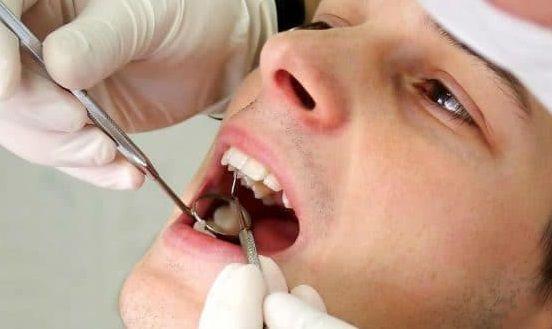 Cáncer bucal: Qué es, síntomas, causas, prevención y tratamiento