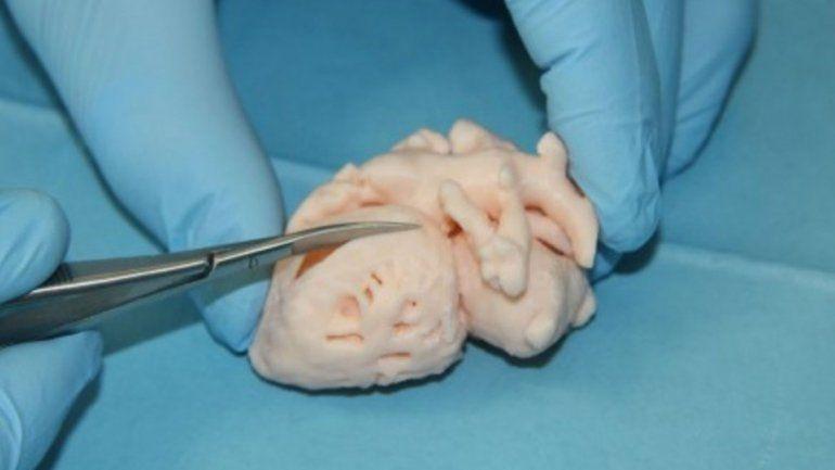 En el Garrahan imprimen corazones 3D para operaciones complejas