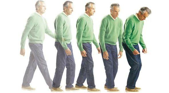 Parkinson: continúa la exploración de nuevas terapias para su tratamiento