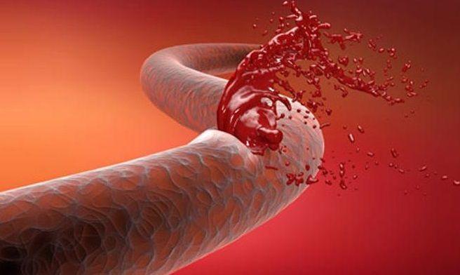 Cerca de 4.500 argentinos padecen hemofilia