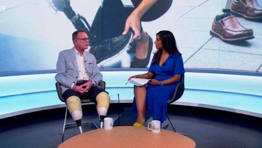 Perdió varias partes de su cuerpo por infección transmitida por su perro