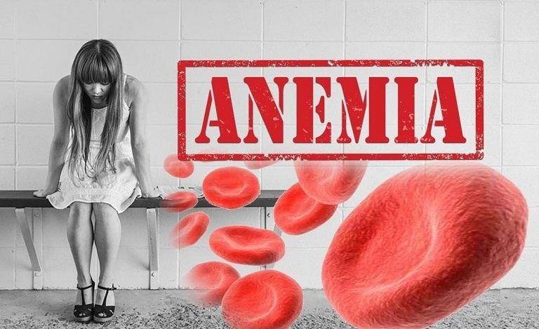 Anemia: Qué es, síntomas, causas, diagnóstico, prevención y tratamiento