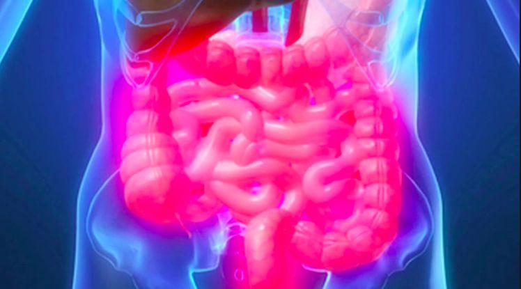 ANMAT aprobó vedolizumab, tratamiento biológico para la Enfermedad Inflamatoria Intestinal