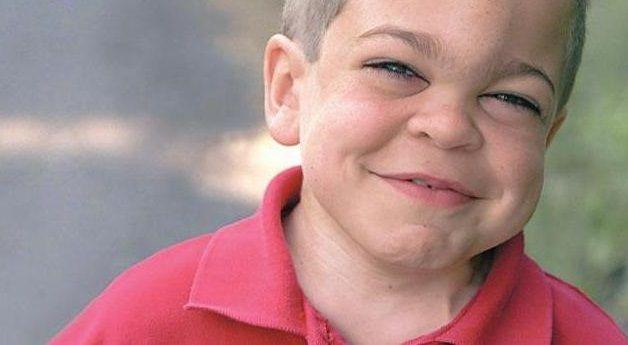 Detectándolas a tiempo, las personas con mucopolisacaridosis pueden vivir mejor