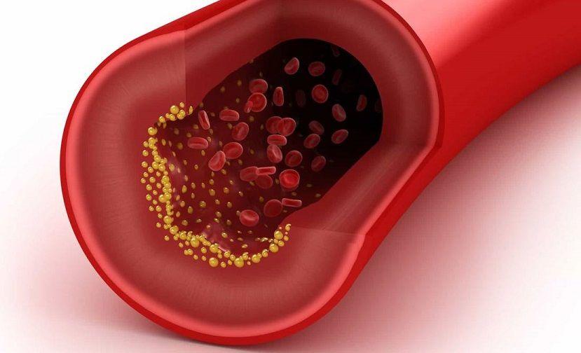 Tener niveles muy bajos de colesterol no supone riesgo para la salud