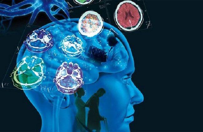 Esclerosis Múltiple: Los factores ambientales y hábitos de vida se relacionan con su aparición